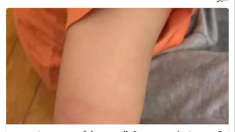 تعذيب أطفال الحضانه،
