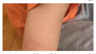 المديرة أجبرت طفلا على أكل قيئه.. تفاصيل صادمة في وقائع التعذيب بحضانة الإسكندرية 