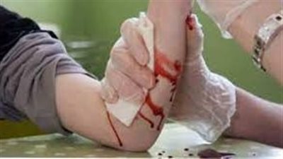 تفسير رؤية الجرح في المنام وعلاقته بتحمل كثير من الهموم والأحزان 