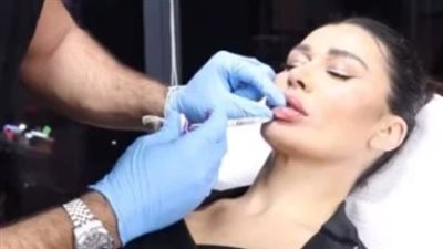 انتقادات حادة لـ نادين الراسي بسبب خضوعها لعملية تجميل | صور