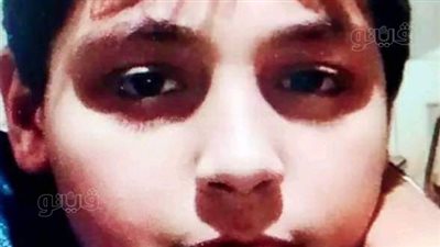 تشييع جنازة الطفل مصطفى ضحية الإهمال الطبي بالغربية 