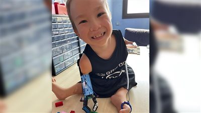 حكاية أول طفل كازاخستاني حامل لطرف اصطناعي متحرك من ليجو 