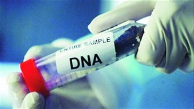 إجراء تحليل DNA لكشف هوية جثة شخص عثر عليها بالشرقية