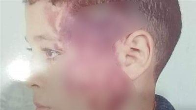 تفاصيل اعتداء معلم على طالب في مدرسة ابتدائي بالدقهلية 