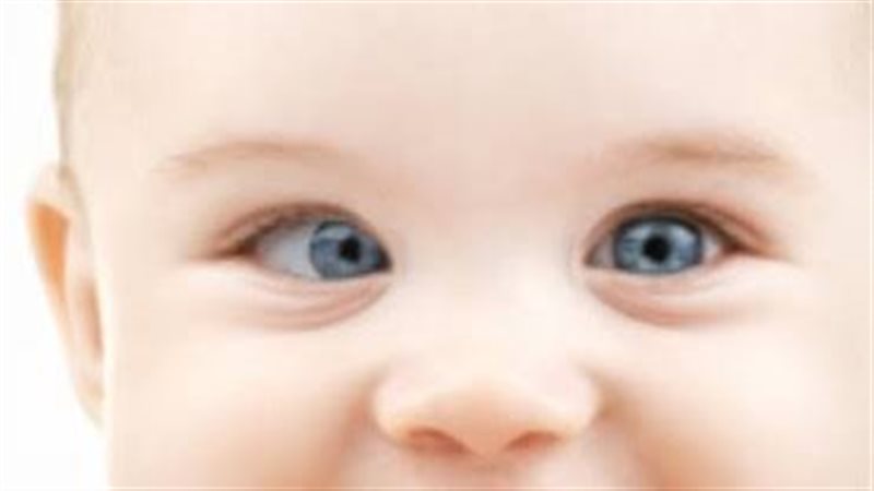 الحول عند الأطفال،
