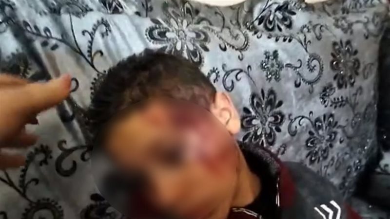 الطالب المصاب بتعليم