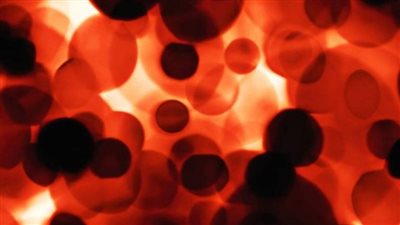 متلازمة هيوز، بعد وفاة طبيب شاب ما هو مرض متلازمة هيوز وأهم أعراضه 