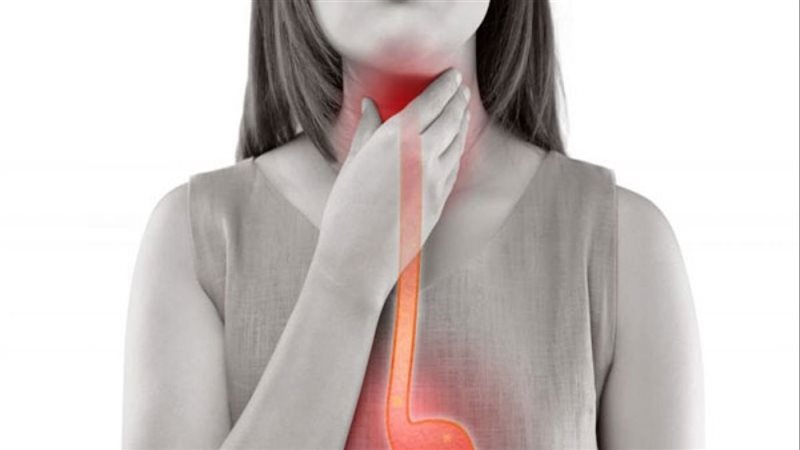 علاج حموضة المعدة،