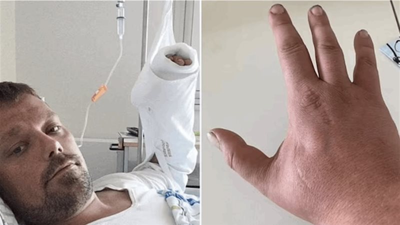شاب توفي جراء عضة