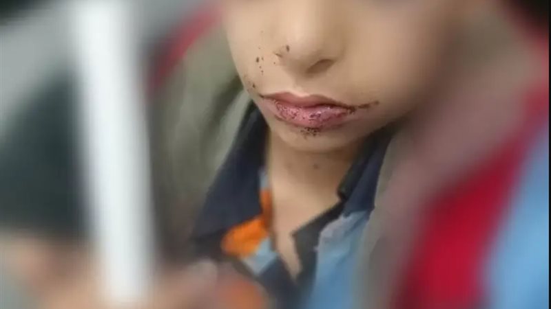 الطالب ضحية المشاجرة