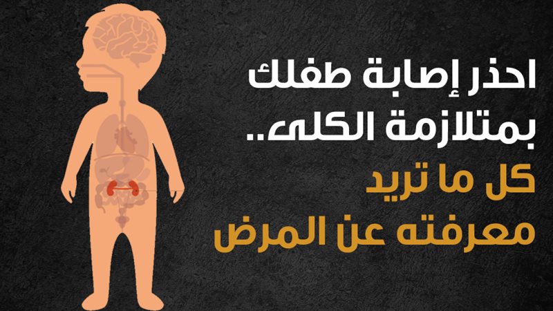 متلازمة الكلي 