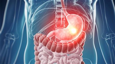  أعراض التهاب المعدة، الألم الحاد مع القيء والغثيان