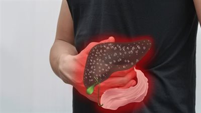 فيروس B، طبيب يحذر من 11 طريقة ناقلة للعدوى