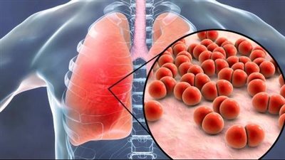 أسباب الانسداد الرئوي المزمن، 5 عوامل تزيد الإصابة 