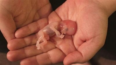 الولايات المتحدة تسمح ببيع حبوب الإجهاض في الصيدليات