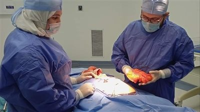 مستشفى قها يجري عملية استئصال ورم حميد