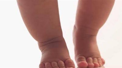 مرض الكساح، أهم الأعراض وأسباب الإصابة