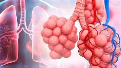 أعراض الأكياس الهوائية على الرئة 