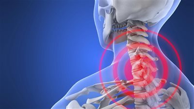  أعراض وأسباب انزلاق الغضروف، ومتى يحتاج المريض إلى جراحة؟