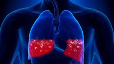 ما هي نوبات مرض الانسداد الرئوي؟ 