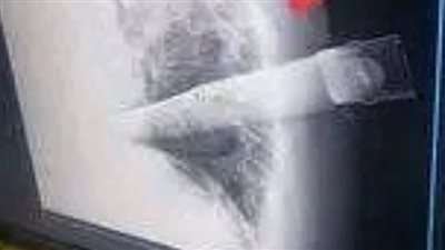 غضب واسع في الجزائر بعد طعن تلميذ لمعلمته