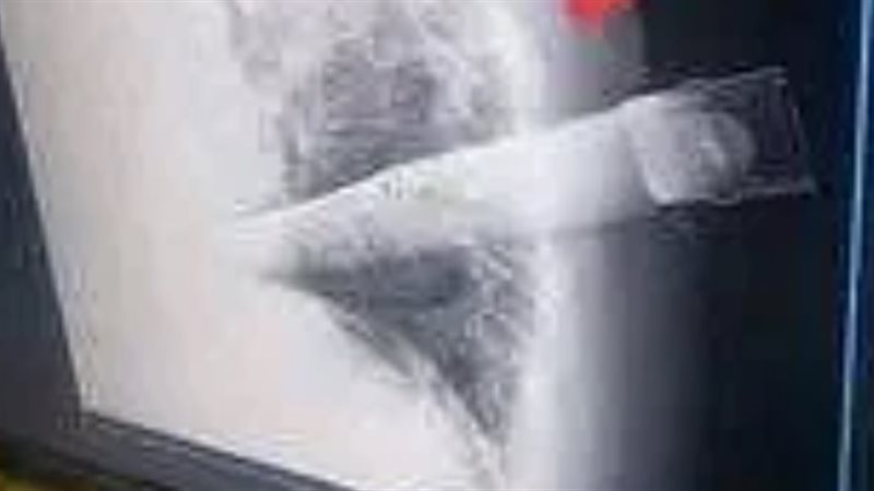طعن تلميذ لمعلمته،