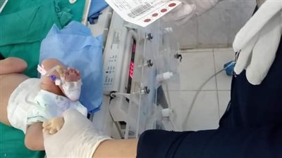 صحة الشرقية: فحص ٢٢ ألف طفل بالمبادرة الرئاسية لكشف الأمراض الوراثية