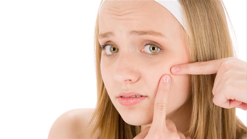 حبوب الوجه وعلاجها،