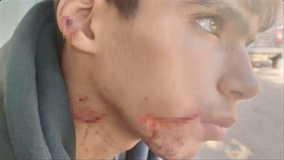 رفض مساعدته في الغش، طالب يشوه وجه زميله بالقليوبية 