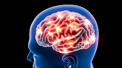 أعراض نزيف المخ 