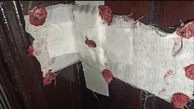 العلاج الحر تغلق مركزًا طبيًا غير مرخص بنبروة