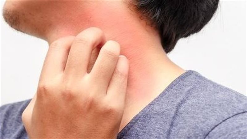 أعراض حكة الجلد،