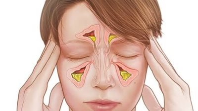 هيئة الدواء تنصح بعدم استخدام المضاد الحيوي في هذه الحالة