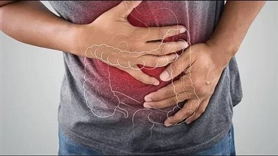 الرعاية الصحية: نجاح إيقاف نزيف قرحة كبيرة بالمعدة لمريض بتكلفة 400 جنيه