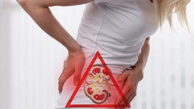 6 طرق بسيطة لعلاج حصوات الكلى بالمنزل