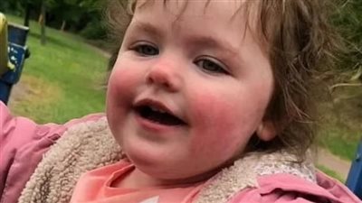  كلب أليف يقتل طفلة عمرها 4 سنوات