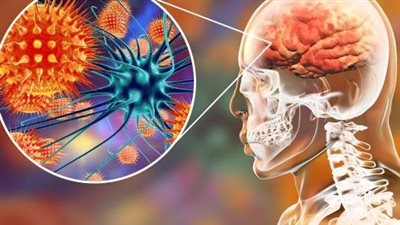 بعدما ضرب الكونغو.. تعرف على وباء التهاب السحايا وطرق الوقاية منه 