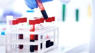 مصائب قوم عند قوم فوائد.. أرباح خرافية لمعامل تحاليل كورونا في ٢٠٢١.. والزيارات المنزلية وسائل المعامل الخاصة لجذب المصريين 