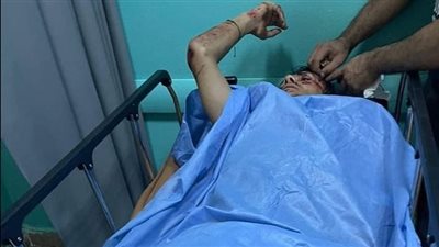 أحداث مؤلمة للفنانين والمطربين.. أبرزها حادث انقلاب سيارة وحريق شقة 