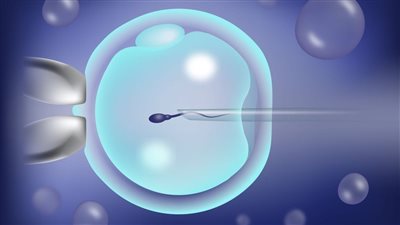  بزنس‭ ‬نقل‭ ‬الأجنة، سبوبة‭ ‬مراكز‭ ‬الحقن‭ ‬المجهرى الأسعار‭ ‬تبدأ‭ ‬من‭ ‬25‭ ‬ألف‭ ‬جنيه‭.. ‬والأدوية‭ ‬بأضعاف‭ ‬الثمن‭ ‬بسبب‭ ‬السوق‭ ‬السوداء