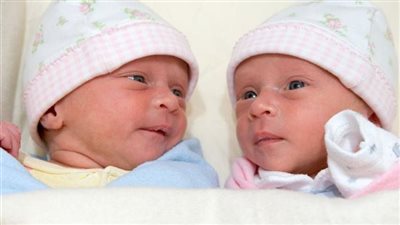  ولادة رضيع يحمل جنينًا في بطنه 