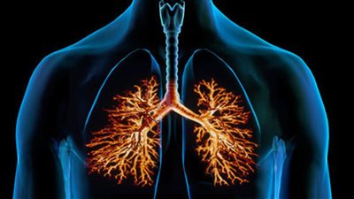 أعراض التهاب الشعب الهوائية، والعلاج بالوصفات والأعشاب الطبيعية