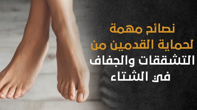 تشققات القدمين في