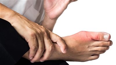 اعراض الروماتويد، أبرزها الأنيميا وتورم المفاصل 