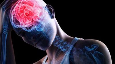  منها الصداع والأرق، أعراض وعلاج ارتجاج الدماغ