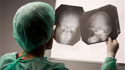 أعراض وعلامات ارتجاج المخ، ومتى يجب زيارة الطبيب؟ 