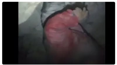 انتشال طفلة من أحضان شقيقتها المتوفاة تحت الأنقاض (فيديو)