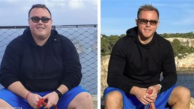 شاب أيرلندي يخسر وزنه بحيلة غريبة