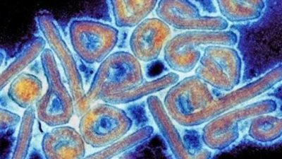 الصحة: تشديد الرقابة على القادمين من غينيا الاستوائية بسبب ماربورج