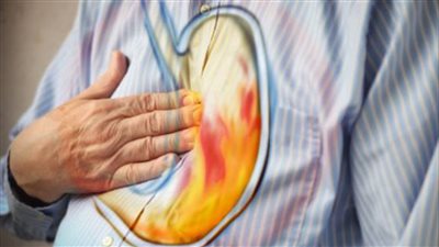 علاج الحموضة في المنزل، بالأعشاب الطبيعية